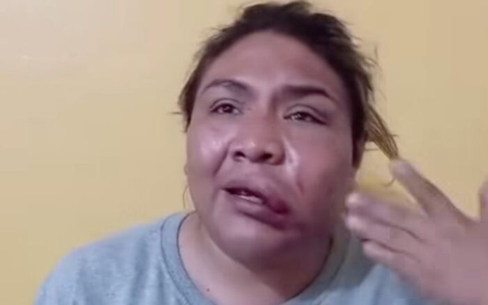 Denuncia Michelle Cano tortura policial en Naucalpan