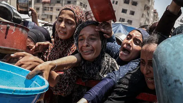 Alerta ONU sobre desnutrición severa en niños de Gaza