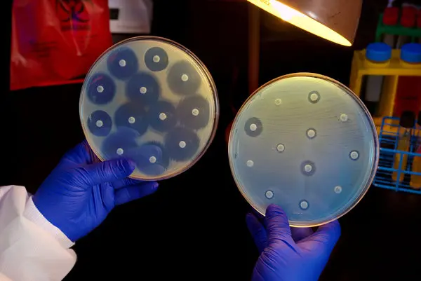 Alerta OMS que México omite datos clave sobre superbacterias resistentes