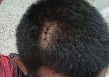 Denuncian abuso policial en Santa María Coyotepec