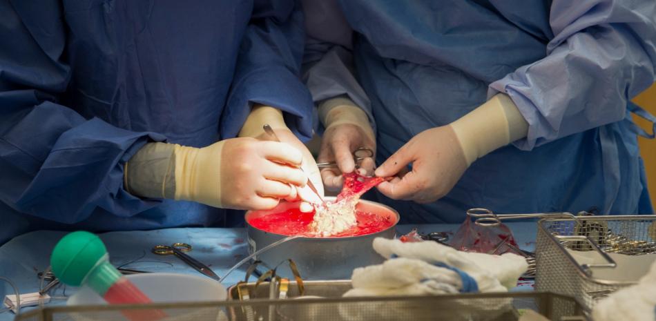 Sobrevive paciente chino 171 días con hígado de cerdo genéticamente alterado