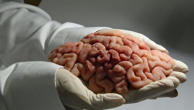 Revela estudio que el cerebro humano nace preconfigurado para comprender el mundo