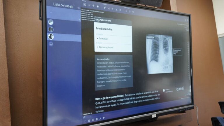 Implementa INER inteligencia artificial para detección temprana de cáncer de pulmón